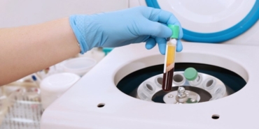 prp tedavisi diz (2)