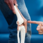 menisküs yırtığı (2)