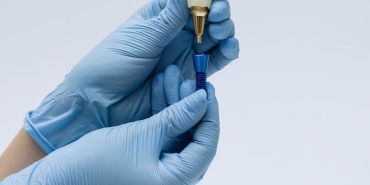 implant tedavisi (2)